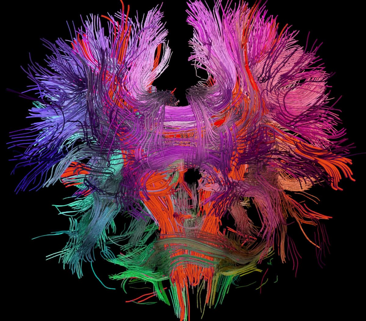 Neural connections in the human brain